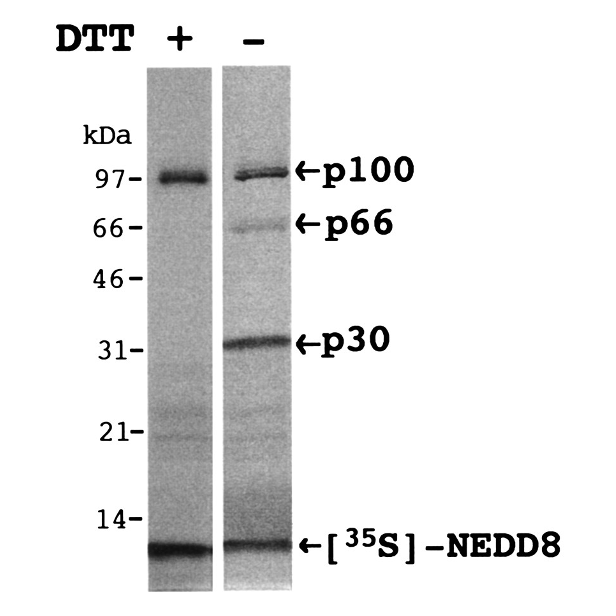 NEDD8-IVT